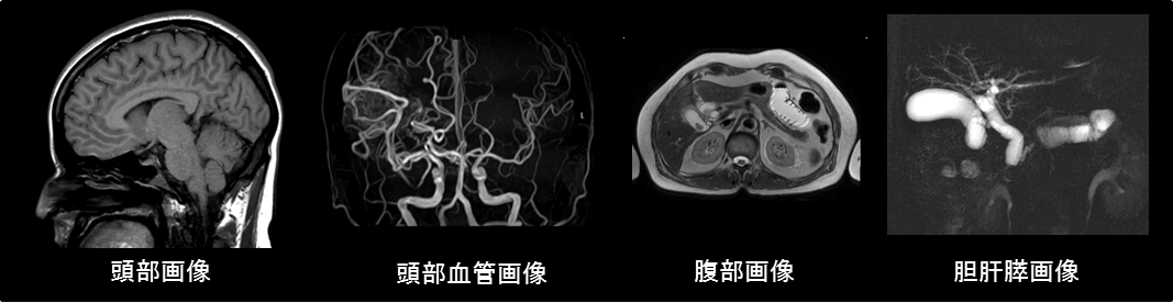 MRI画像